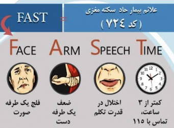 علائم بیمار حاد سکته مغزی را بشناسیم.